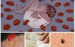 Как избавиться от ковровых блох инсектицидными и подручными средствами